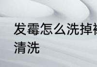 发霉怎么洗掉裙子霉斑 裙子霉斑怎么清洗