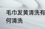 毛巾发黄清洗有哪些方法 毛巾发黄如何清洗